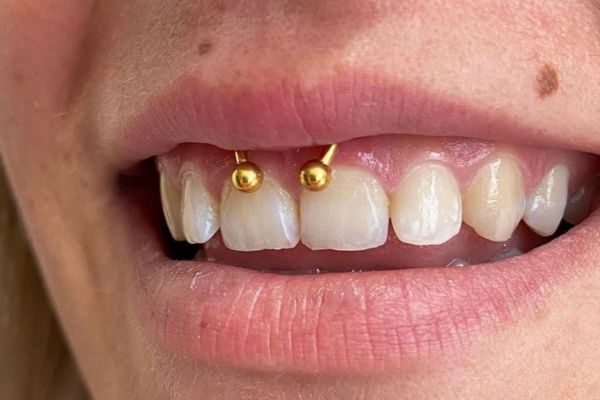 Giá xỏ khuyên môi - Xỏ khuyên Smiley