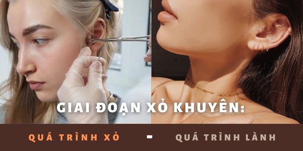 Giai đoạn xỏ khuyên
