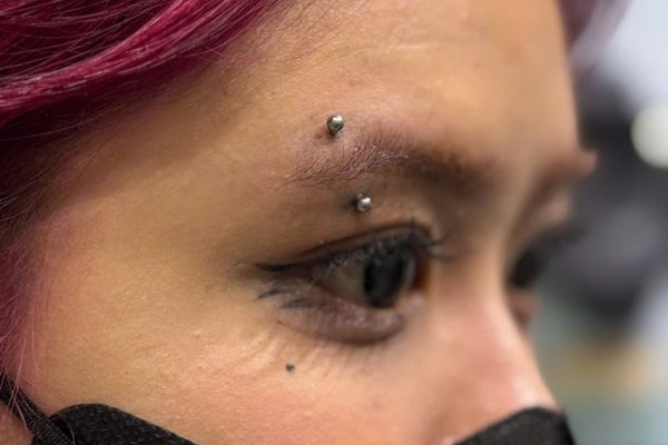 Giải pháp trị bump lỗ xỏ sau xỏ khuyên hiệu quả tại TinyBox