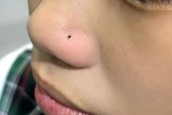 xỏ khuyên cánh mũi