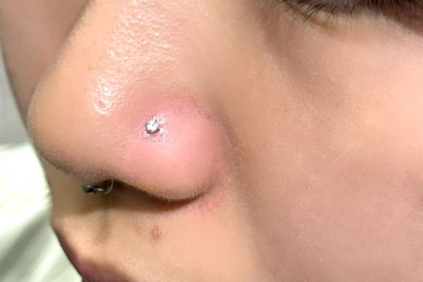 xỏ khuyên cánh mũi