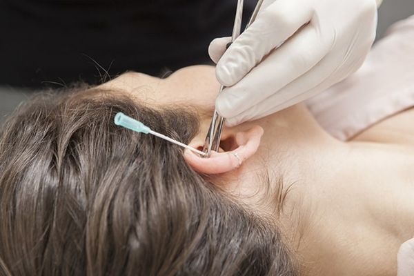 Học xỏ khuyên cấp tốc là gì?