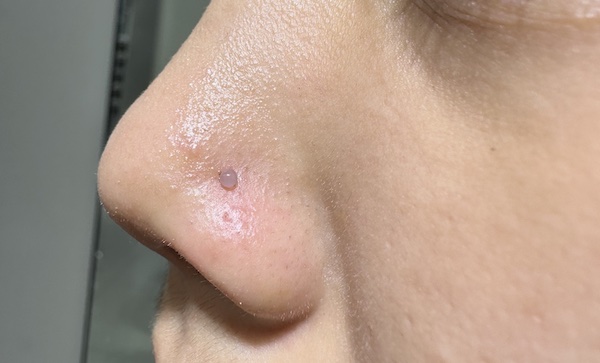 Ảnh khách xỏ mẫu chuẩn xác - xỏ mẫu cánh mũi