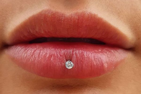 Tháo khuyên môi 2 ngày không gắn lại được phải làm sao?