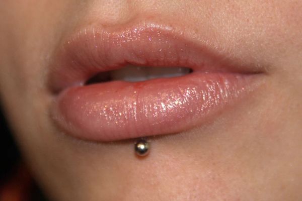 Tháo khuyên môi 2 ngày không gắn lại được phải làm sao?