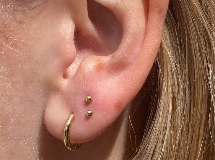 Lỗ khuyên tai bị chảy nước ngứa