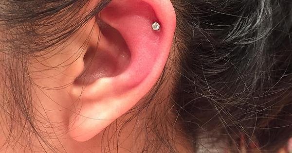 Lỗ khuyên tai bị chảy nước ngứa