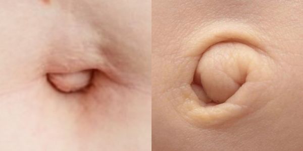 Lỗ rốn như thế nào thì nên xỏ và không nên xỏ?