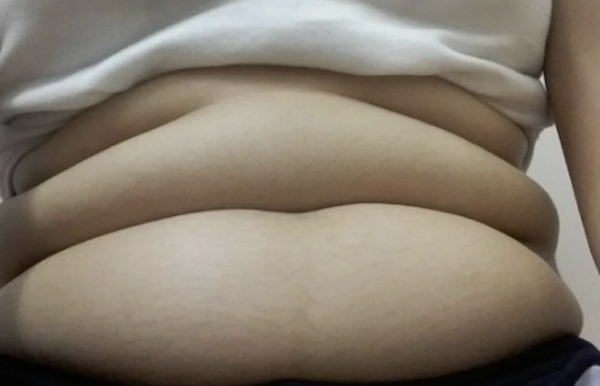 Lỗ rốn như thế nào thì nên xỏ và không nên xỏ?