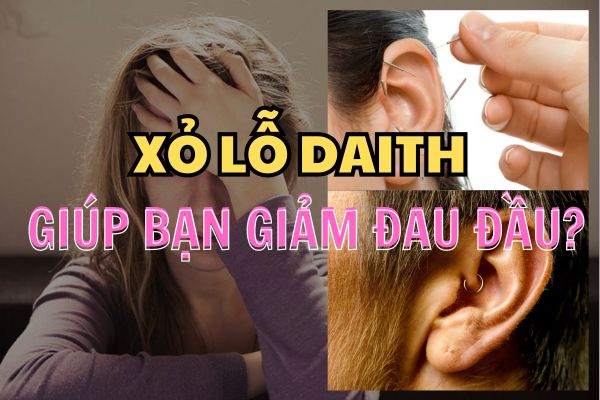 Lỗ xỏ Daith có thực sự giúp bạn giảm đau đầu?
