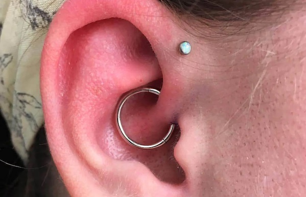 Lỗ xỏ Daith có thực sự giúp bạn giảm đau đầu?