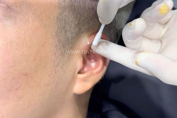 cách vệ sinh Lỗ xỏ Forward Helix