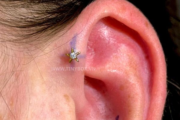 Lỗ xỏ Forward Helix