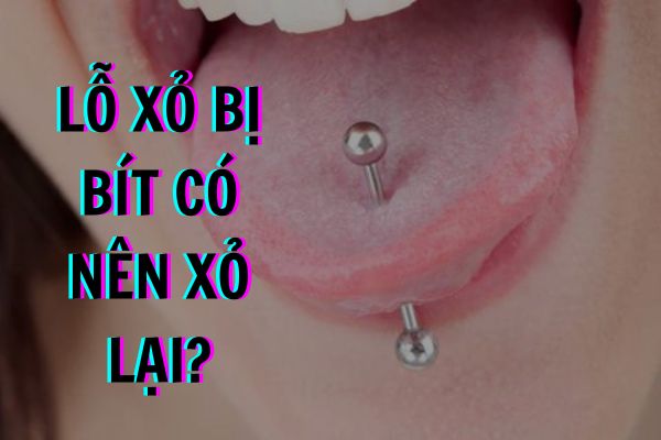 Lỗ xỏ khuyên bị bít có xỏ lại được không?