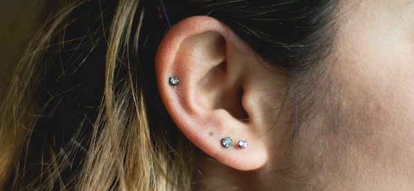 Lỗ xỏ khuyên bị đen