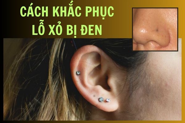 Lỗ xỏ khuyên bị đen