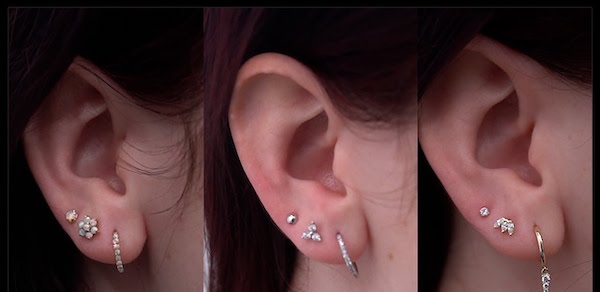 Lỗ xỏ khuyên bị lệch