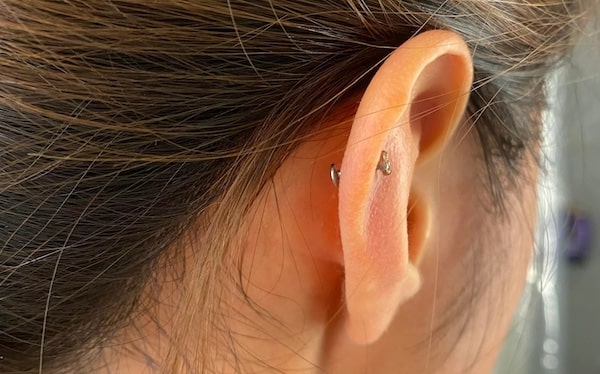 Lỗ xỏ khuyên bị lệch