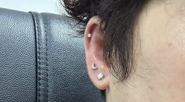 Lỗ xỏ khuyên bị nhiễm trùng có nên đi bệnh viện không?