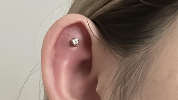 Lỗ xỏ khuyên bị nhiễm trùng có nên đi bệnh viện không?