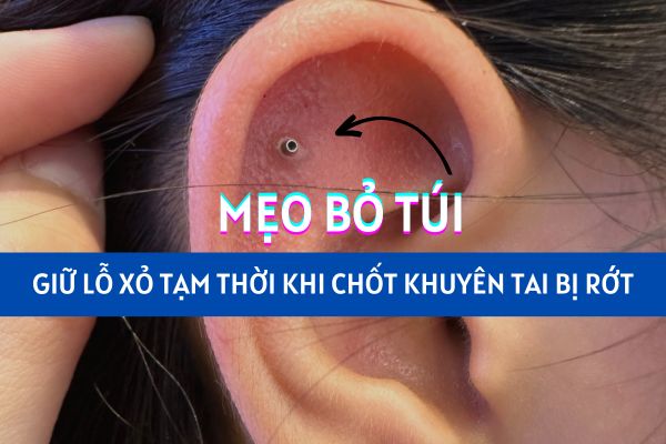 Lỗ xỏ khuyên bị rớt chốt làm sao để giữ lỗ tạm thời?