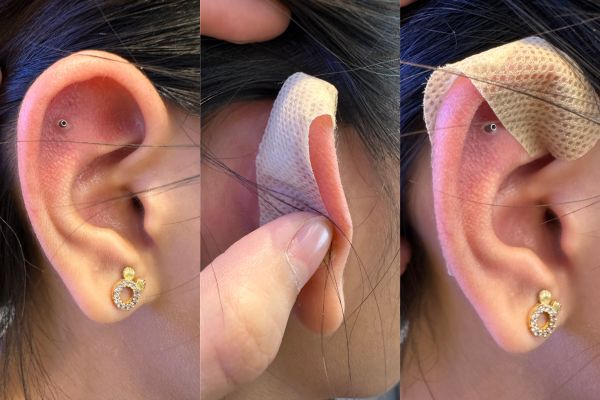 Lỗ xỏ khuyên bị rớt chốt làm sao để giữ lỗ tạm thời?