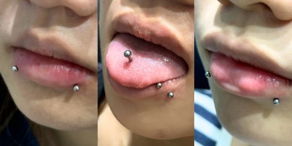 Lỗ xỏ khuyên bị sưng đau