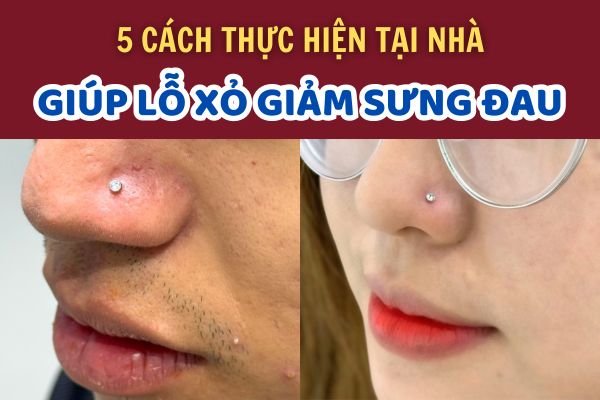 Lỗ xỏ khuyên bị sưng đau