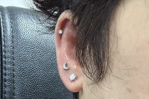 Nhận biết lỗ xỏ khuyên tai bị sưng viêm nặng