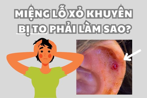 Miệng lỗ xỏ khuyên bị lở có sao không