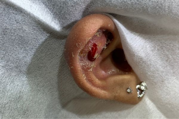 Mới bấm lỗ tai đeo bạc được không?