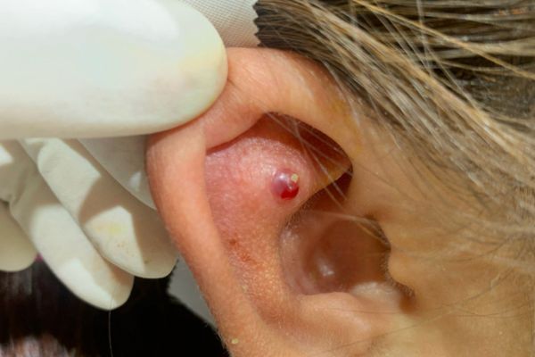 Mới bấm lỗ tai tháo ra được không?