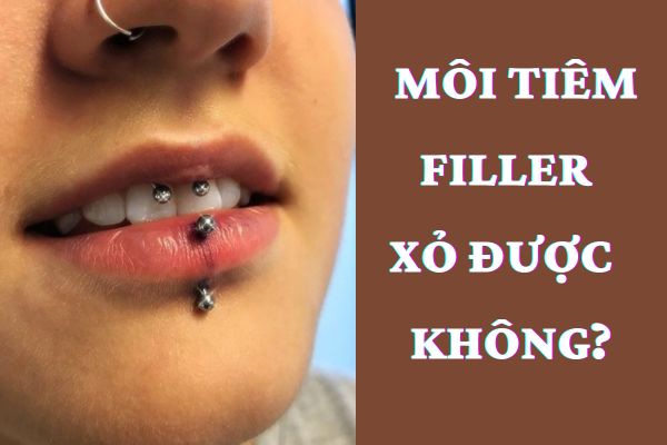 Môi tiêm filler có xỏ khuyên miệng được không?
