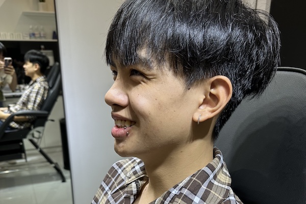 Môi tiêm filler có xỏ khuyên miệng được không?