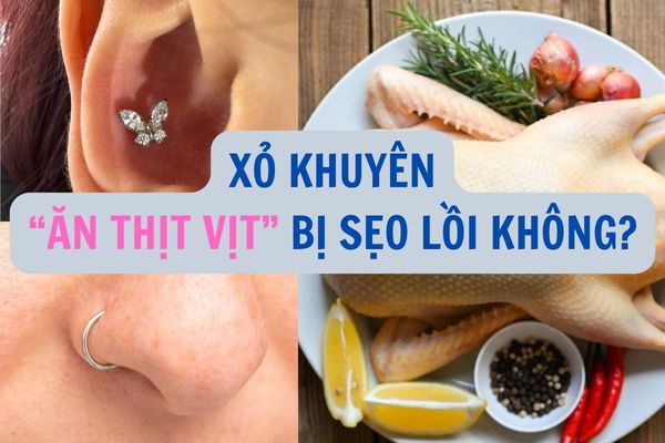 Mới xỏ khuyên ăn thịt vịt có bị sẹo lồi không?