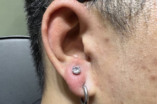 Hình ảnh khách nam xỏ khuyên tai - TinyBox xỏ khuyên