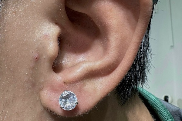 Nam xỏ khuyên tai mặt đá