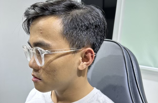 Hình ảnh nam xỏ sụn tai chất