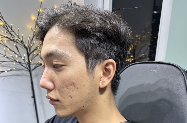 Con trai xỏ thịt tai