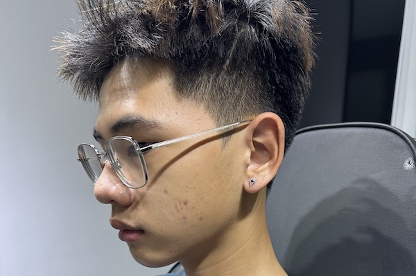 Con trai xỏ thịt tai