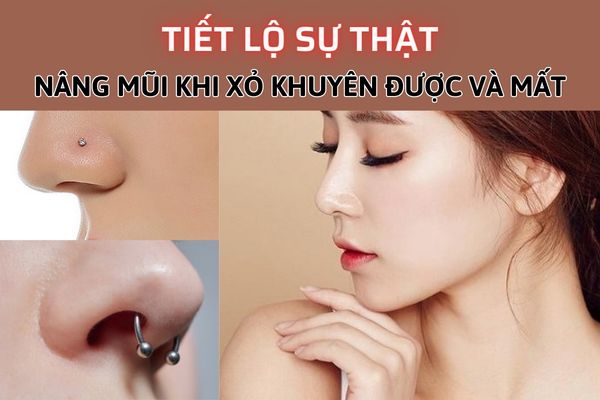 Nâng mũi có xỏ khuyên mũi được không?