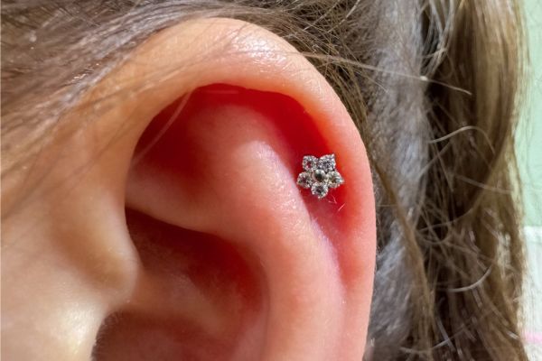 Nhét tỏi vào lỗ xỏ khuyên được không?