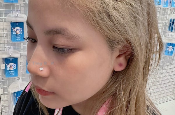 Phá nốt ruồi phong thuỷ bằng cách xỏ khuyên mũi tinybox