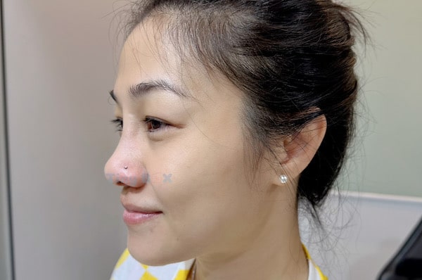 Phá nốt ruồi phong thuỷ bằng cách xỏ khuyên mũi tinybox