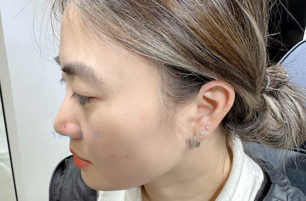 Phá nốt ruồi phong thuỷ bằng cách xỏ khuyên mũi tinybox