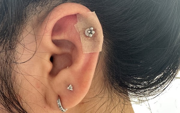 Phác đồ điều trị bump tại TinyBox