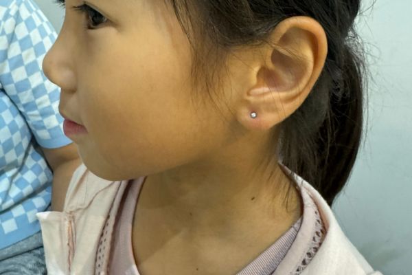 So sánh giá xỏ khuyên em bé và người lớn