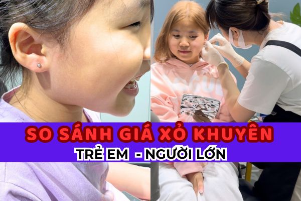 So sánh giá xỏ khuyên em bé và người lớn