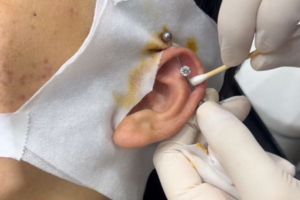 Tại sao không nên đẩy khuyên khi lỗ xỏ chưa lành?