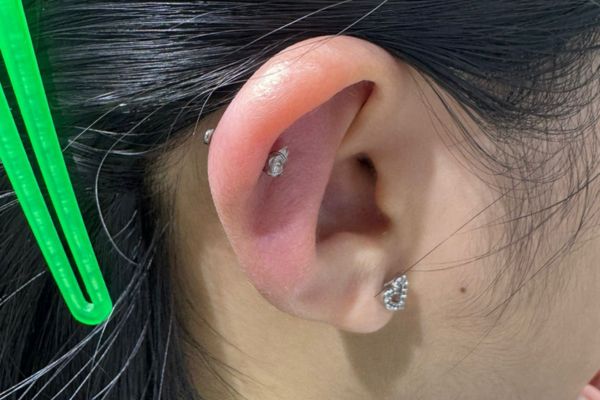 Lỗ xỏ bị sưng to đột ngột và chảy mủ là dấu hiệu cảnh báo nhiễm trùng cần được xử lý ngay.